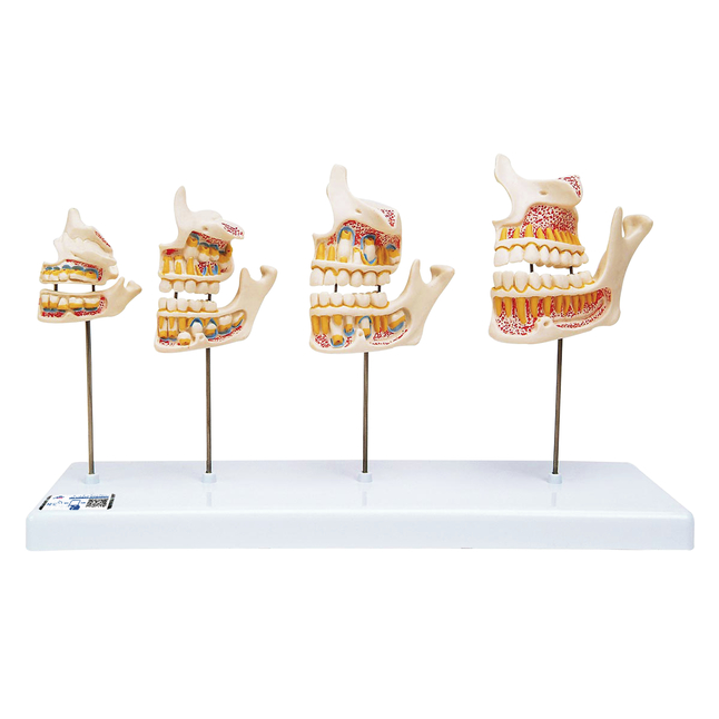 Image for 3B Scientific Dentition Development from School Specialty