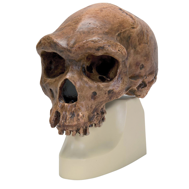 3B Scientific Broken Hill Human Skull, Item Number 2091116