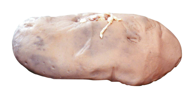 Frey Scientific Choice Preserved Pig Organs, Kidneys, Double Injected, Pack of 1, Item Number 2102653