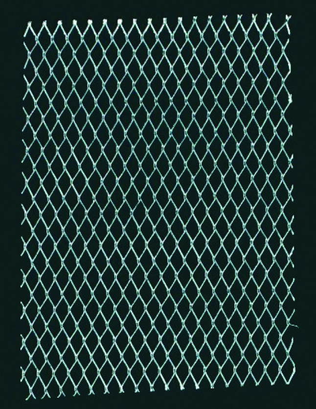 expandable wire mesh